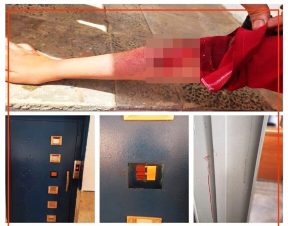 سهل‌انگاری در نصب شیشه و حفاظ برای درب آسانسور در گرگان حادثه آفرید