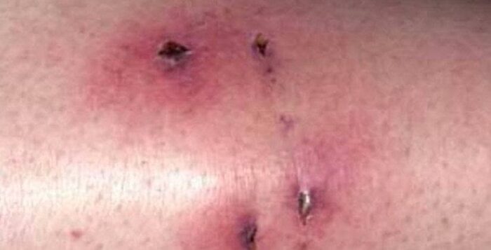 ۷۰ درصد سگ‌گزیدگی‌ها توسط سگ‌های خانگی